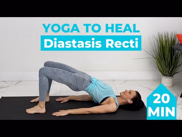 Will yoga help diastasis recti?