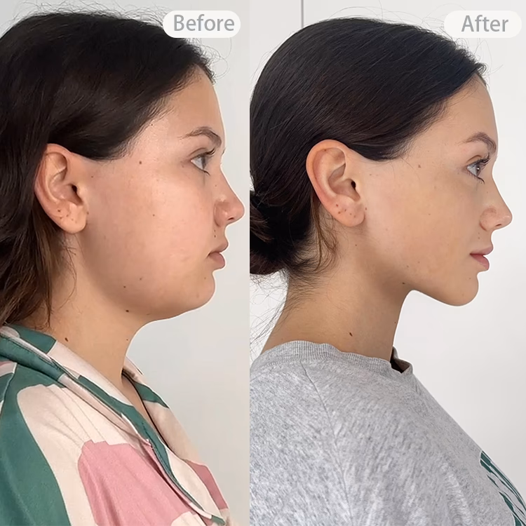 Does yoga for face really work?