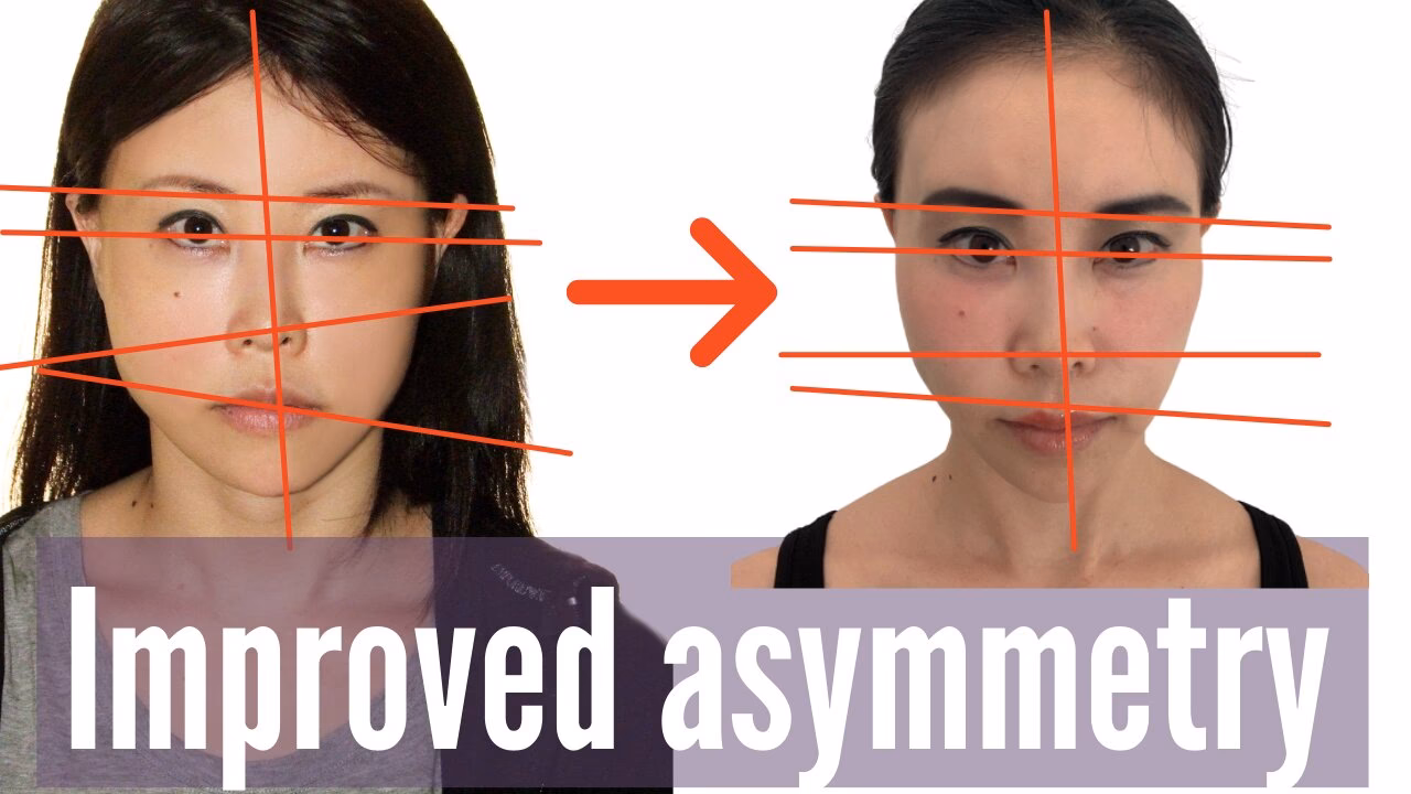 Can face yoga make your face symmetrical?