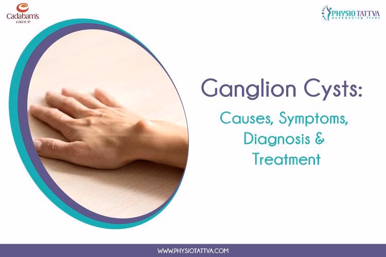 Can exercise reduce ganglion cysts?
