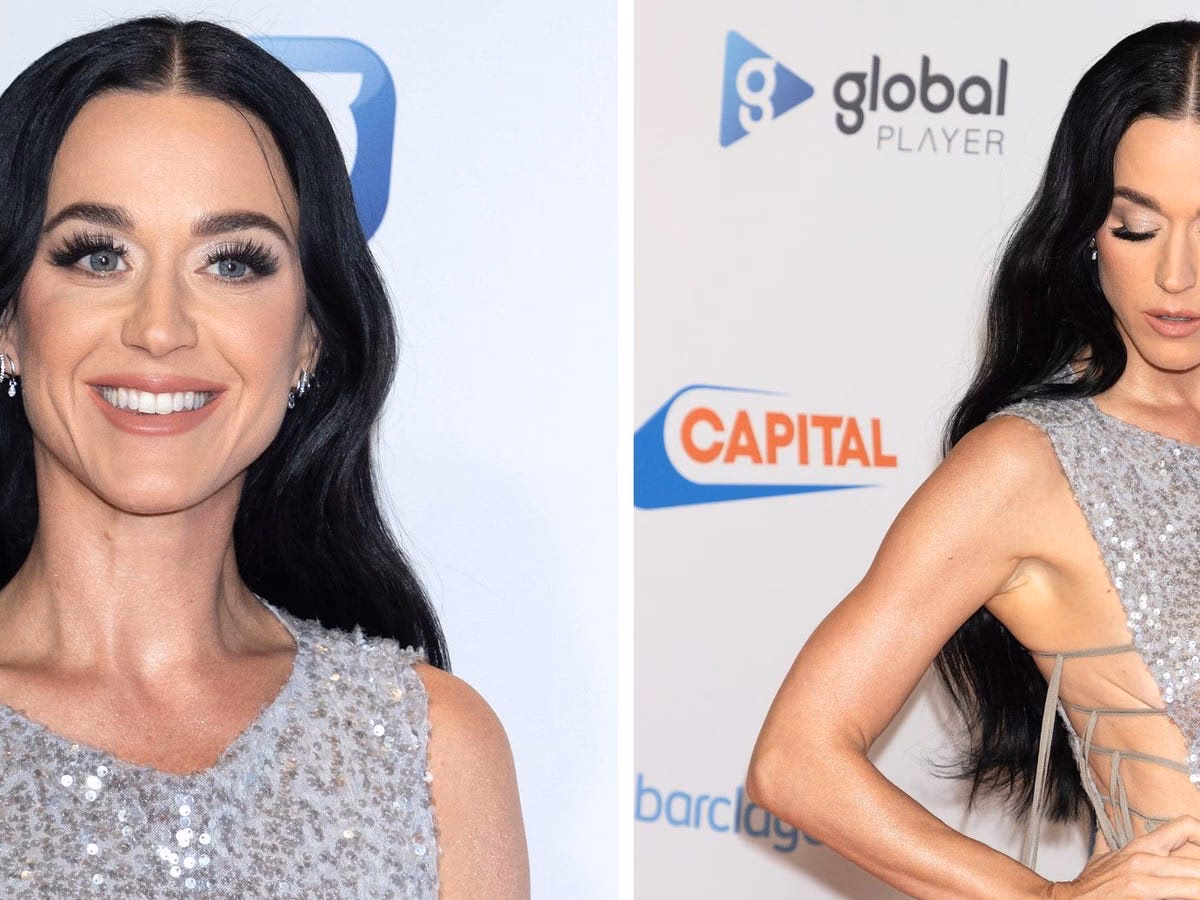 What caused Katy Perry's eye to close?