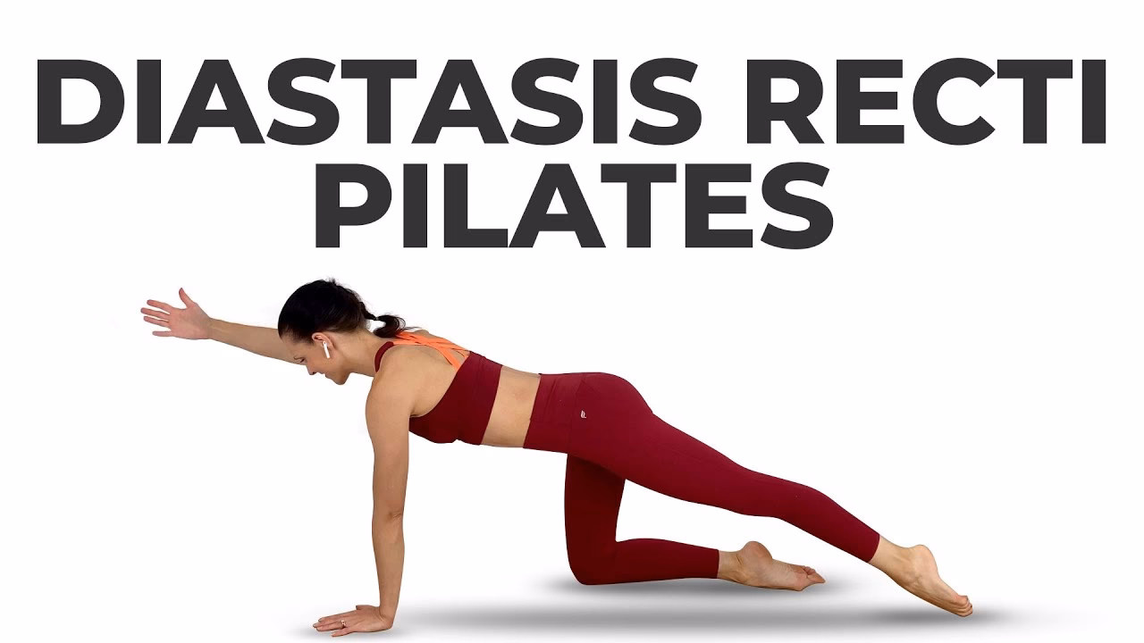 Will Pilates heal my diastasis recti?