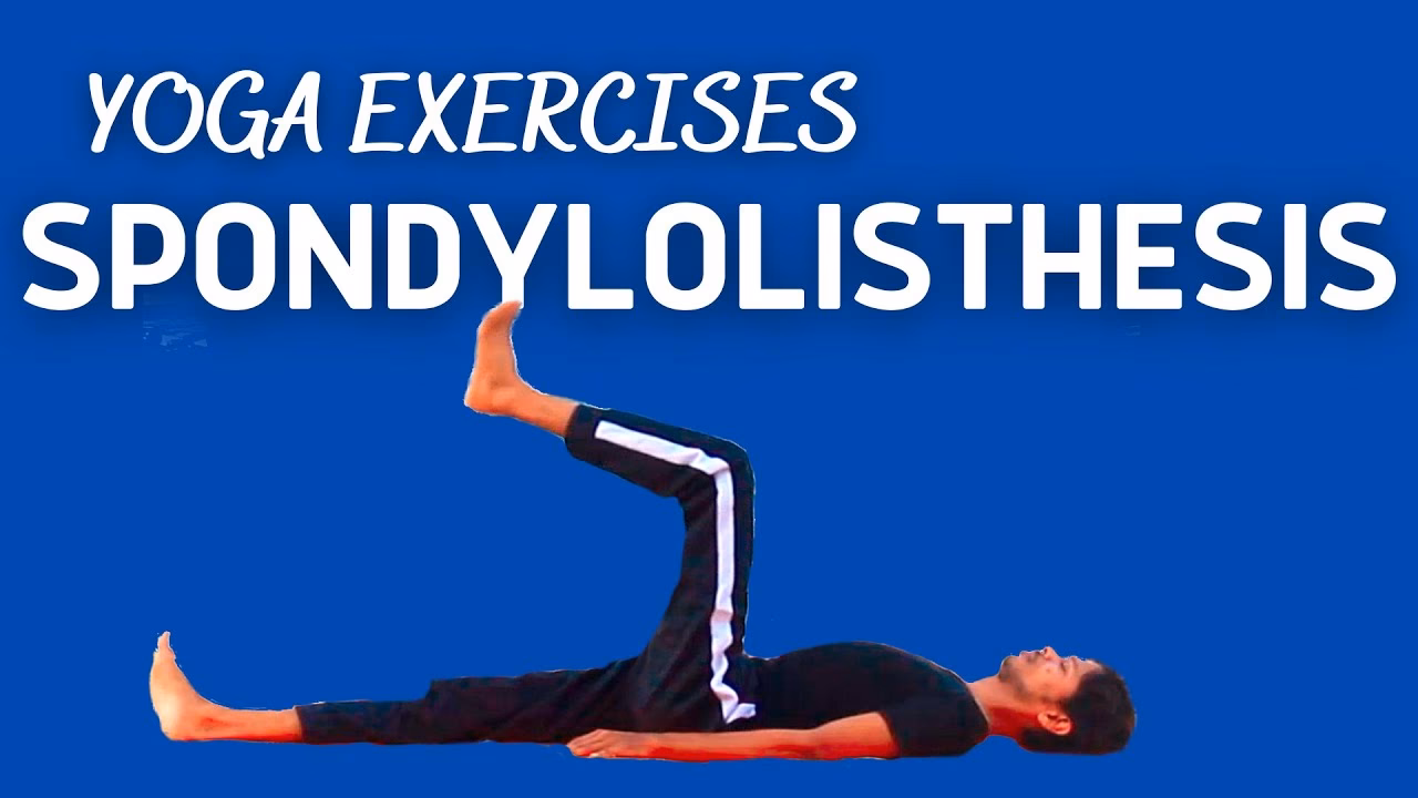 Is yoga ok for spondylolisthesis?