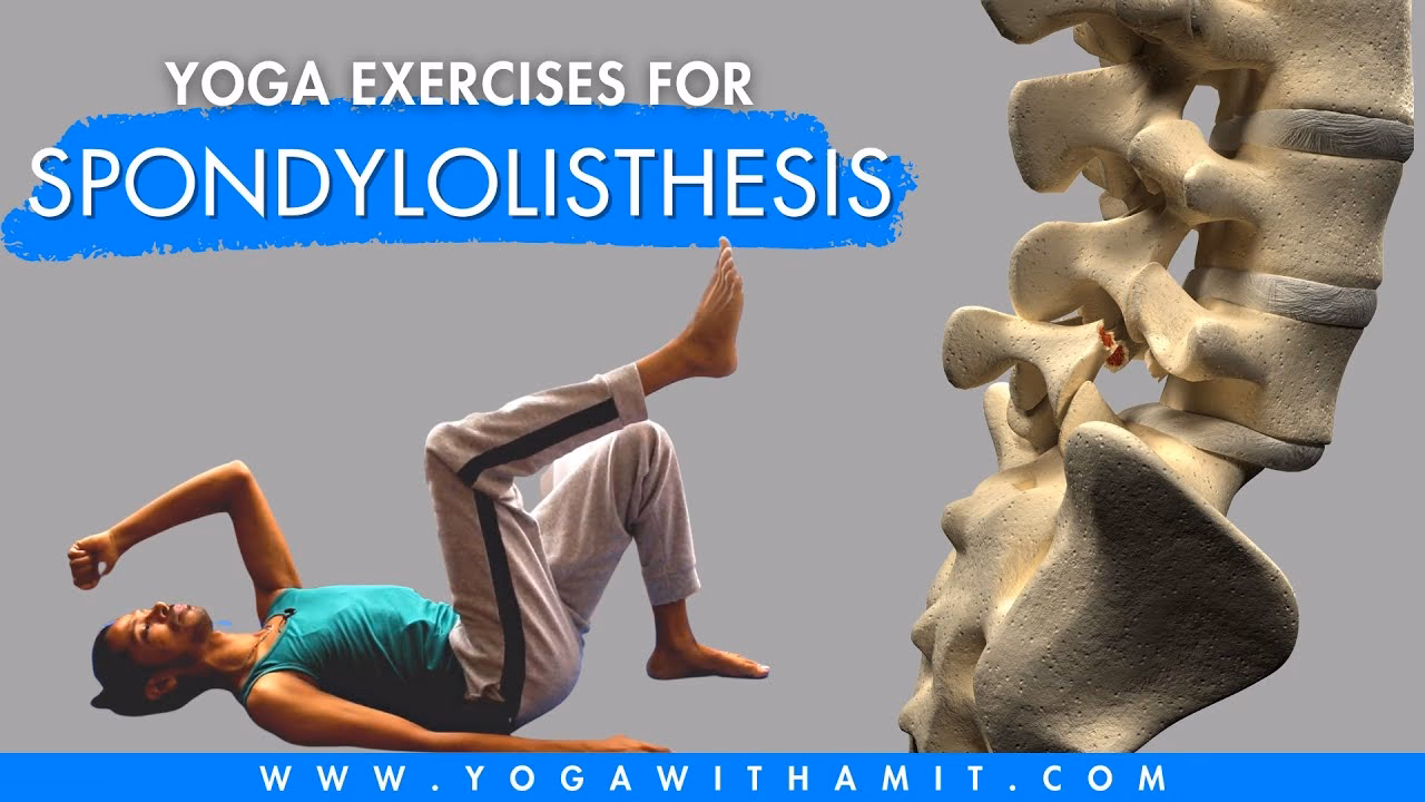 What yoga poses should be avoided with lumbar spondylosis?
