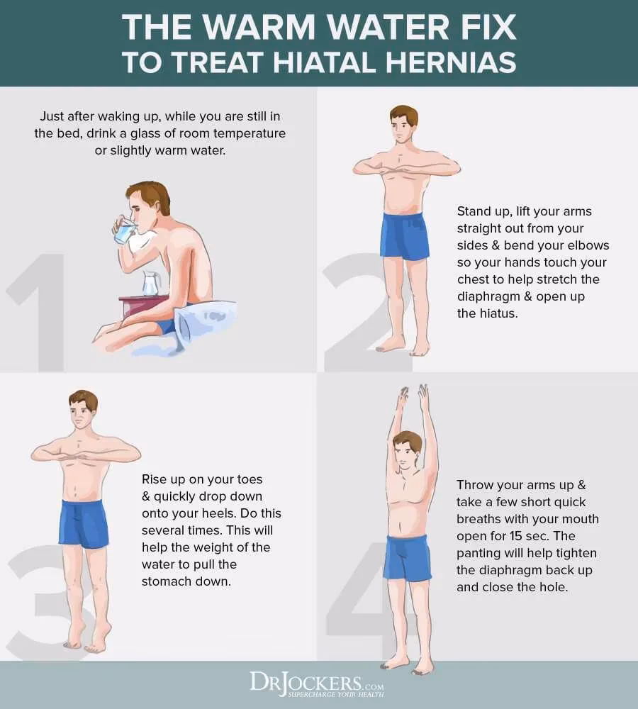 Is yoga good for a hiatal hernia?