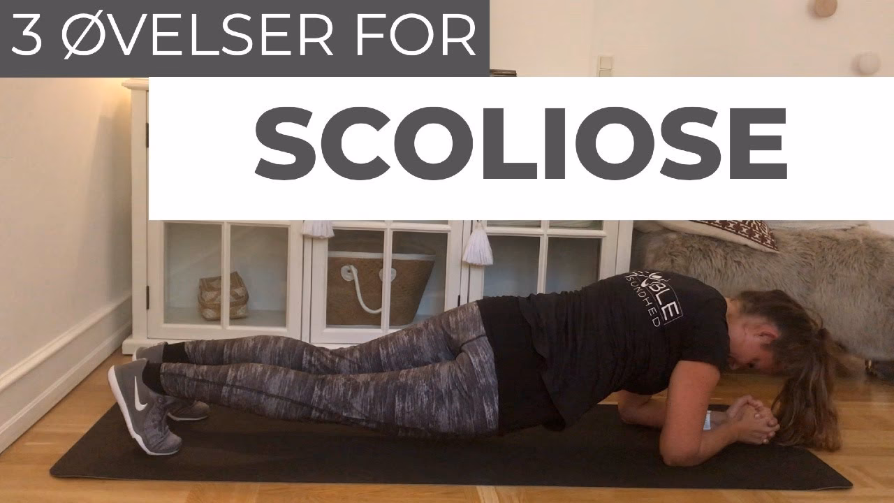 Hvad hjælper på skoliose?